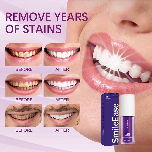 Hismile v34 Color Corrector Serum – Instant Teeth Whitening - Image 3
