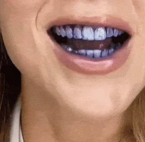 Hismile v34 Color Corrector Serum – Instant Teeth Whitening - Image 4