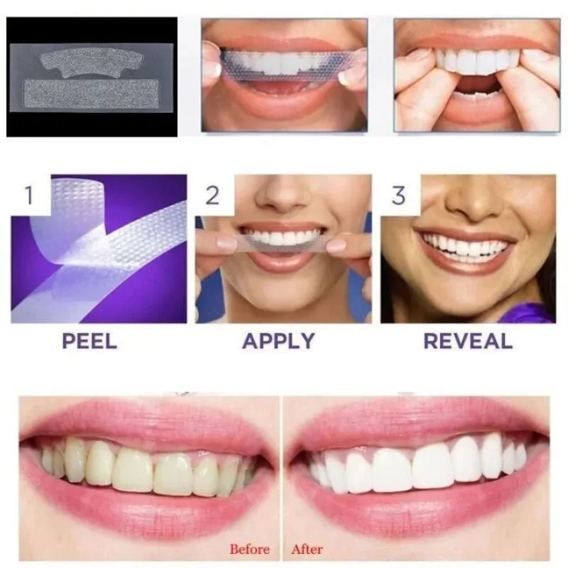 Gegemoon 3D Teeth Whitening Strips | Professional 7-Day Whitening Kit | Enamel Safe Whitening Strips | Deep Stain Removal | Mint Flavor | 7 Pairs - Image 4
